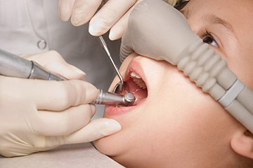 лечение зубов под седацией