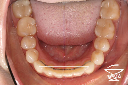 После лечения лечения