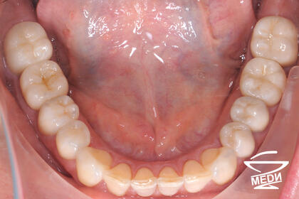 После лечения лечения