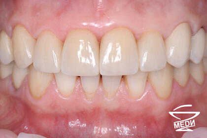 После лечения лечения