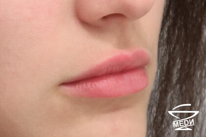 После выполнения плана лечения