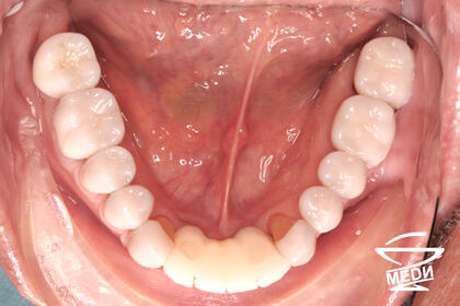 После лечения лечения