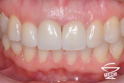 После лечения лечения