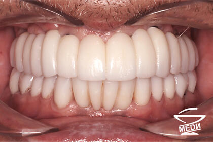 После лечения лечения