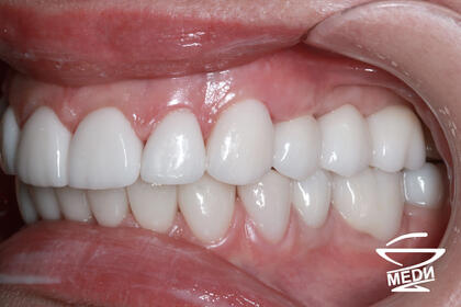 После лечения лечения