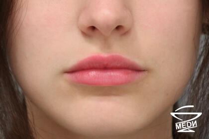 После выполнения плана лечения