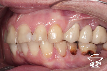 До начала лечения