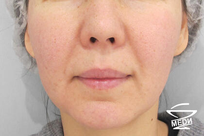 После выполнения плана лечения