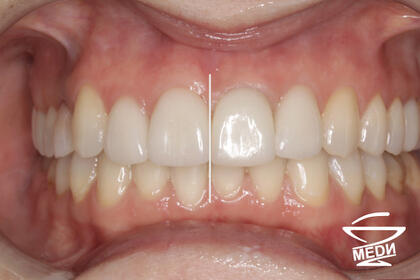 После лечения лечения