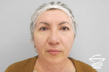 После выполнения плана лечения