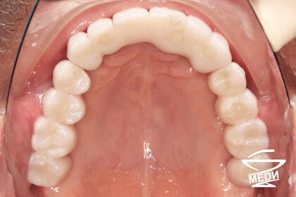 После лечения лечения