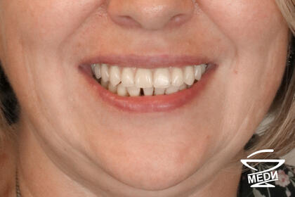 После лечения лечения