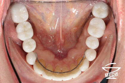 После лечения лечения