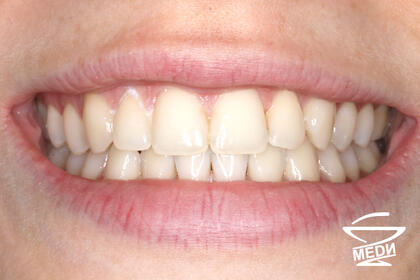 После лечения