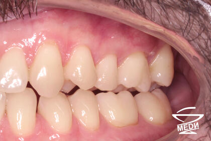 После лечения лечения