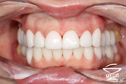 После лечения лечения