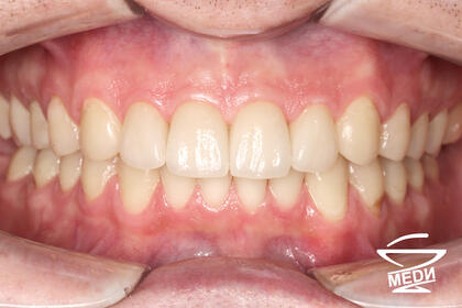 После лечения лечения