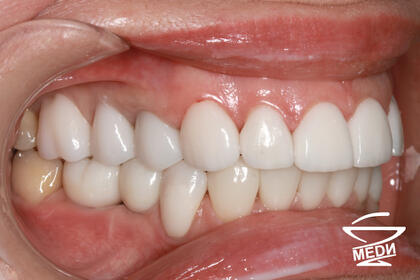 После лечения лечения