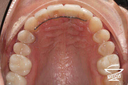 После лечения лечения