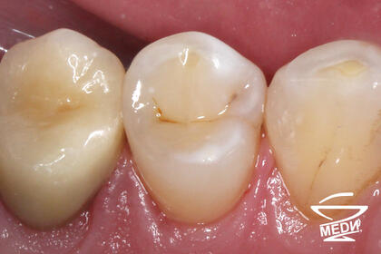 После лечения лечения